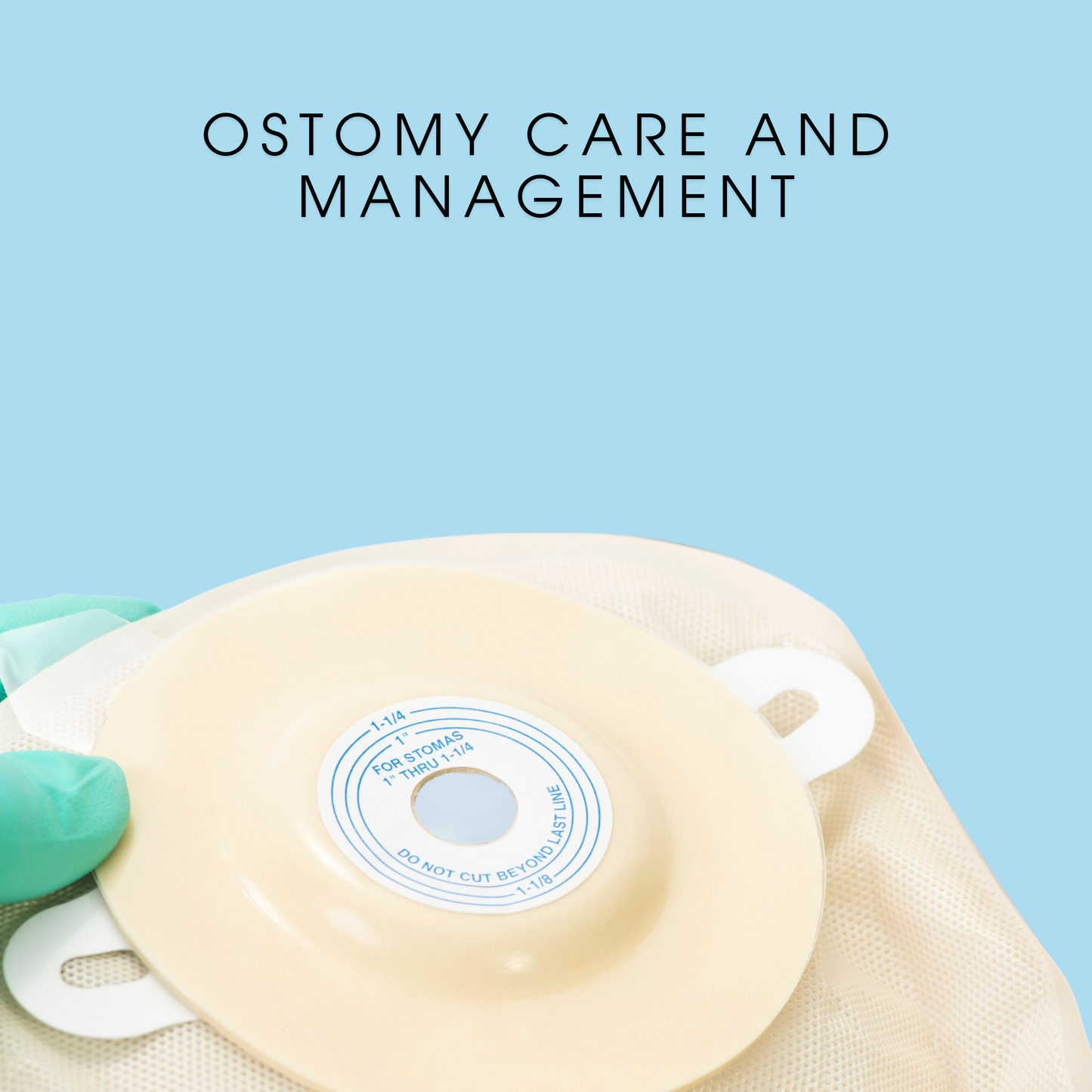 Ostomy Care and Management